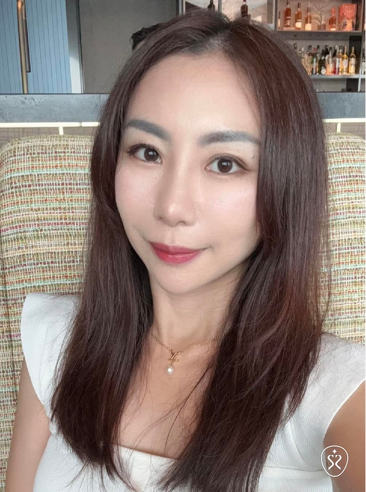 喬雅登玻尿酸效果真的很自然，術後護理記得多喝水敷保濕面膜